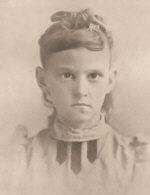 After Treatment for Cross Eyes