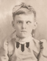 Before Treatment for Cross Eyes.